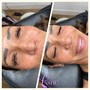 Express facial