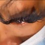 Eyelash Extension Removal