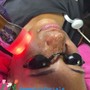 Speciality Facial