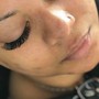 Eyelash Extension Removal