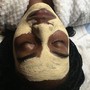 Chemical Peel