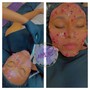 Non Invasive Double Chin treatment