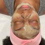 Microdermabrasion