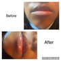 Eyelash Extension Removal