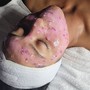 Microneedling Facial