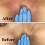 Underarm Wax