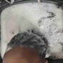 Scalp Treatment