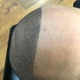 Hair Line  enhancement