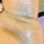 Underarm Facial