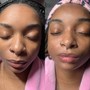 Facial Cupping