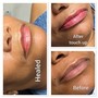 Lips neutralization and blushing (pigmented lips)