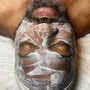 Acne Facial