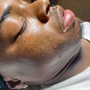 Microdermabrasion