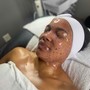 Face Reality chemical Peel