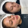 Couples Facial