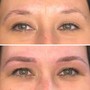 Eyebrow: Microblading