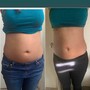 60 minute ultrasonic cavitation -6 sessions