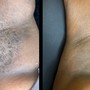 Ingrown hair Vajacial w/ full Brazilian wax