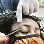 DANDRUFF SCALP TREATMENT