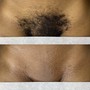 Men’s Brazilian Wax