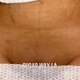 Men's Back Wax