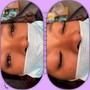 Express facial