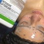 Chemical peel face #vipeel