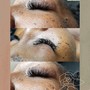 Eyelash Extension Removal