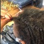 Soft loc removal