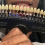 Teeth Whitening