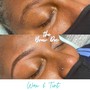 Acne Facial