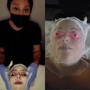 Dermaplaning facial