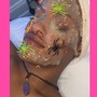 Teen Acne Facial