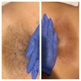 Brazilian Wax