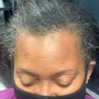 Scalp Treatment