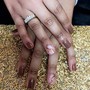 Nail Repairs