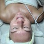 DERMPLANE FACIAL