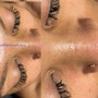 Eyelash Extension Removal