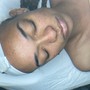 Glycolic Peel