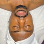 Back Facial