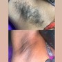 Brazilian Wax