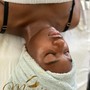 Microdermabrasion