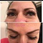 Eyelash Extension Removal