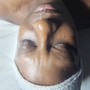 Dermaplaning facial