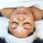 Microdermabrasion Facial