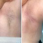 Men’s Brazilian Wax