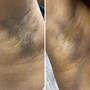 Men’s Brazilian Wax