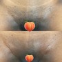 Men’s Chest Wax