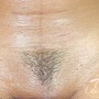 Men Brazilian Wax