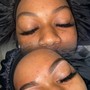 Microdermabrasion (Add-On)